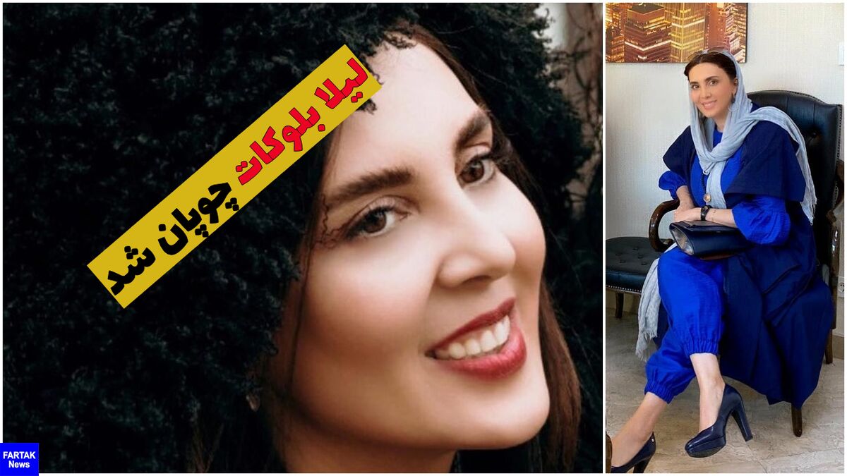 باورنکردنی/ لیلا بلوکات چوپان شد + عکس