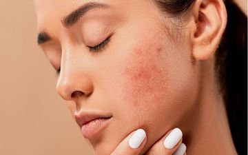 اگر میخواهید جوان بمانید این ۶ خوراکی را حذف کنید