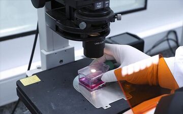 
راه انتقال و علائم آبله میمونی را بشناسید