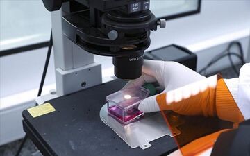 
راه انتقال و علائم آبله میمونی را بشناسید