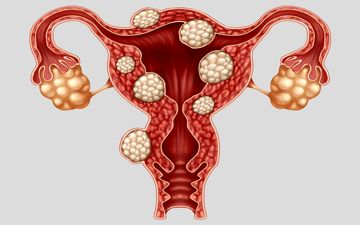 خانم ها حتما حتما این درد را جدی بگیرند!