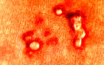 چگونه میشود فهمید که HPV داریم؟


