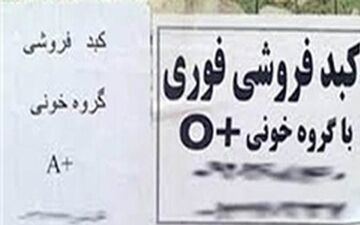 ماجرای فروش کبد ۵۰۰ میلیونی در تهران چه بود ؟