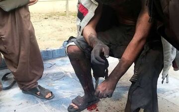  انفجار مواد محترقه در دست نوجوان 16ساله تهرانی 