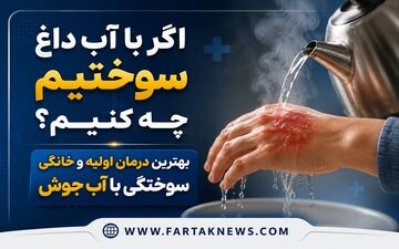 اگر با آب داغ سوختیم چه کنیم؟ بهترین درمان اولیه و خانگی سوختگی با آب جوش