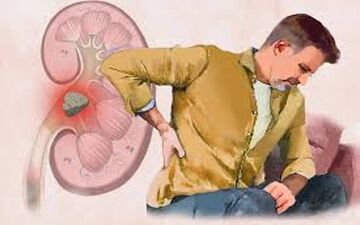 آیا مصرف کلسیم باعث سنگ کلیه می‌شود؟
