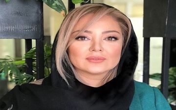 عمل زیبایی روی چهره “خانم بازیگر” حسابی جواب داد/ عکس