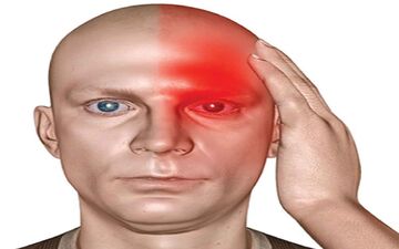 علل سردرد در نواحی مختلف چیست؟