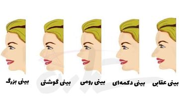  تست شخصیت شناسی از روی فرم بینی| رازهای شما برملا می شود!