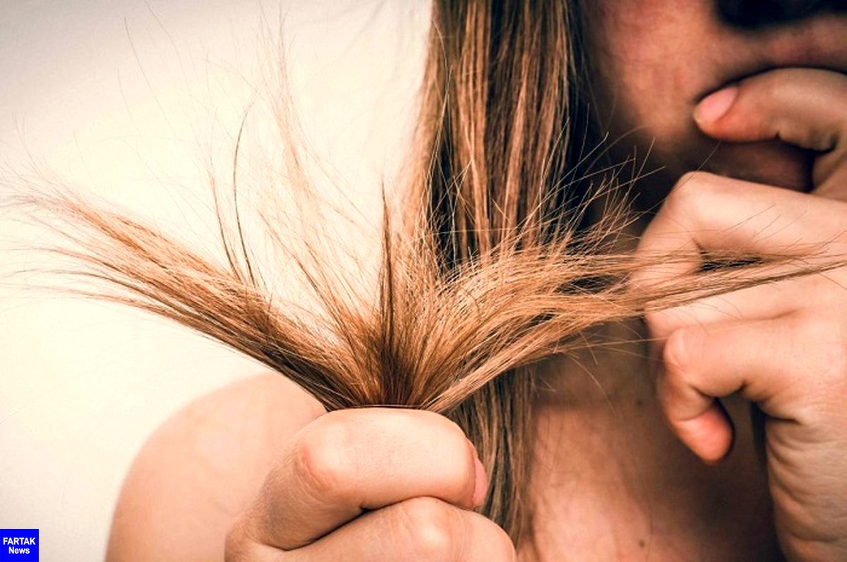 موخوره چیست + انواع روش های رفع موخوره