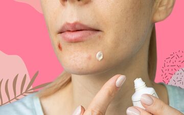 آیا استفاده از خمیر دندان برای بهبود جوش‌های صورت موثر است؟