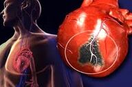 آیا بعداز حمله قلبی قلب دوباره میتواند مثل قبل شود؟