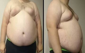 این عامل هم جزو عوامل مهم در ابتلا به سرطان است!