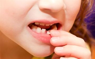دندان‌های شیری بی اهمیت هستند؟