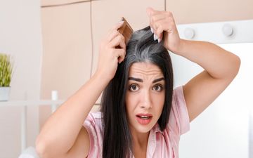 علل اصلی سفید شدن موها چه هستند؟| آیا می‌توان موهای سفید شده را دوباره سیاه کرد؟