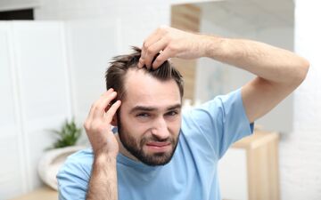 هشدار به کم‌خواب‌ها: کچلی، عاقبت بی‌خوابی‌های شما!