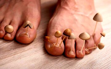  تخم‌مرغ گندیده، سلاحی تازه علیه قارچ‌های ناخن!