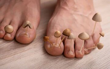  تخم‌مرغ گندیده، سلاحی تازه علیه قارچ‌های ناخن!
