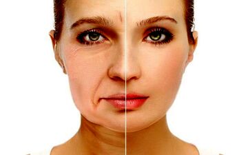 
روشی برای جلوگیری از افتادگی پوست پس از رژیم