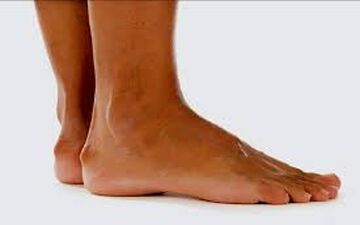 علت ایجاد خار پاشنه چیست؟