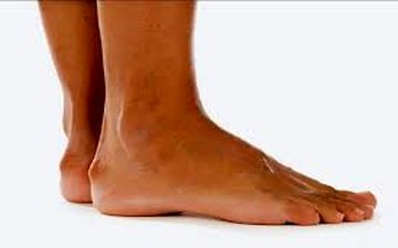 علت ایجاد خار پاشنه چیست؟