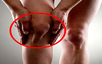 قفل شدن زانو| علل و علائم قفل شدن زانو چیست؟