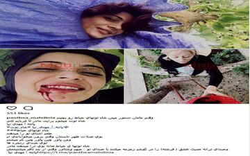 ژست های جالب بازیگر زن، روی درخت شاه توت! (عکس)
