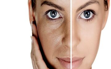 دمنوش های مناسب برای جوانسازی و شادابی پوست