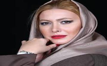خانم بازیگر،قبل و بعد از جراحی بینی