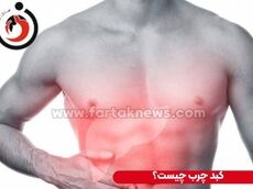 ۷ زنگ خطر کبد چرب؛ چه کسانی باید بیشتر مراقب باشند؟