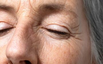 چگونه ظهور چین و چروک‌های صورت را به تأخیر بیندازیم؟