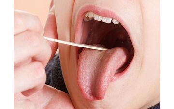 اگر زبان تان زردرنگ است این مطلب را بخوانید

