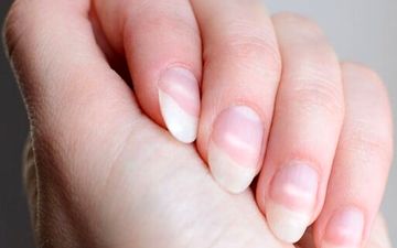 چه بیماری هایی از ظاهر ناخن‌ها مشخص است؟


