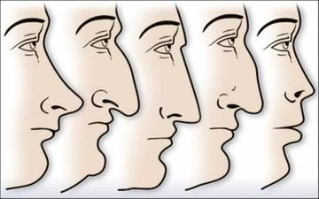 شخصیت شناسی از روی فرم بینی