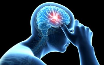  یک روش مهم پیشگیری از سکته مغزی ثانویه
