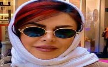  تغییرات ظاهری فلور نظری درپی جراحی های زیبایی عجیب