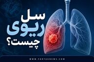 خطر بازگشت یک قاتل باستانی؛ از سرفه‌های ۳ هفته‌ای تا تعریق شبانه و خلط خونی با بیماری سل!