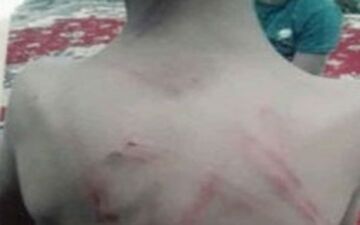  شلاق معلم ورزش بر بدن دانش‌آموز ۹ ساله 