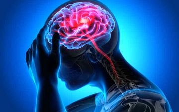
علائم اصلی سکته مغزی چیست؟