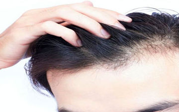 بیوتین برای رشد مو
