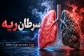 سرفه‌های مداوم را جدی بگیرید؛ سرطان ریه چه علائمی دارد؟