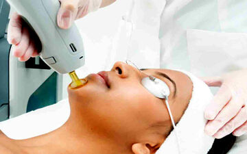 اگر لیزر را ادامه ندهیم چه میشود؟ آیا پیوسته بودن جلسات لیزر مهم است ؟