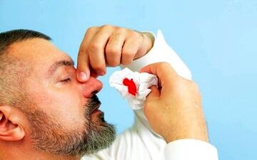  علت بروز خون‌دماغ در افراد چیست؟

