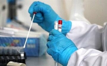 اعلام آخرین فهرست آزمایشگاه های تشخیص کووید ۱۹ 
