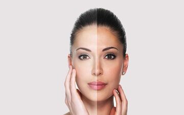 میخوای پوستت شفاف مثل آیینه بشه؟ این کارهای ساده و موثر رو انجام بده
