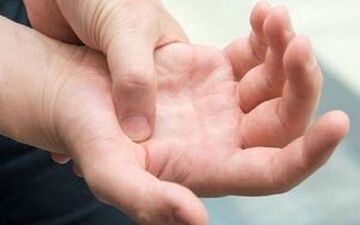 
خارش کف دست به چه علت است؟
