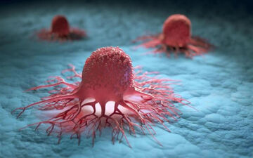 چرا مردان، بیشتر از زنان سرطان می گیرند؟