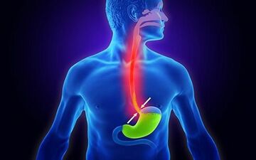 رفلاکس معده اذیتت میکنه؟ درمانش رو نمی دونی؟ بیا تا همه چی رو بهت بگم!