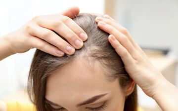 خطر پنهان ترند سال! این مدل موی پرطرفدار عامل طاسی دائمی زنان است