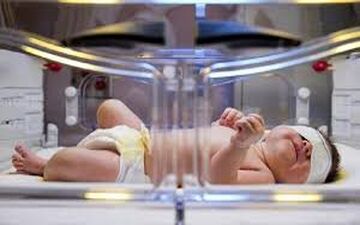 زردی تا چه حد میتواند برای سلامت نوزاد خطرناک باشد؟